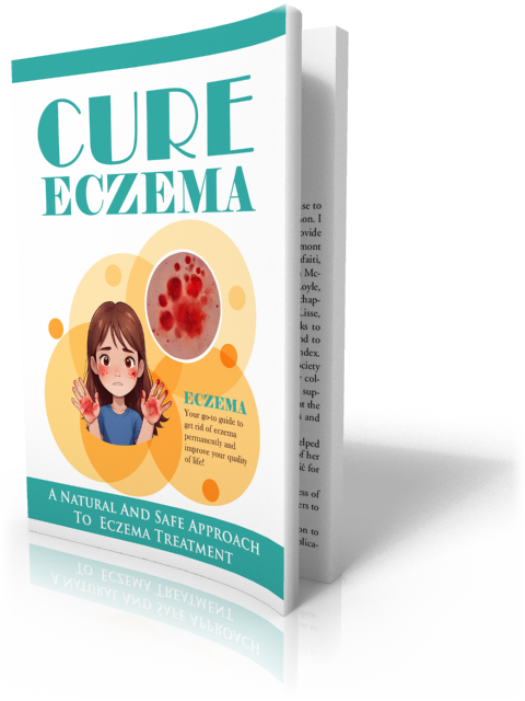 Cure Eczema: How to Get Rid of Eczema Naturally & Permanently